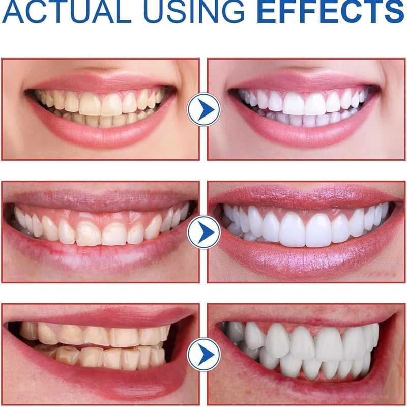 ✨ AEXZR® SP-8 Probiotic Whitening Toothpaste – Gently Erases Stains for a Brighter Smile 😁