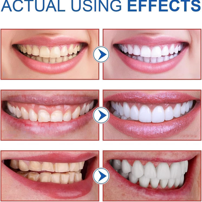 ✨ AEXZR® SP-8 Probiotic Whitening Toothpaste – Gently Erases Stains for a Brighter Smile 😁
