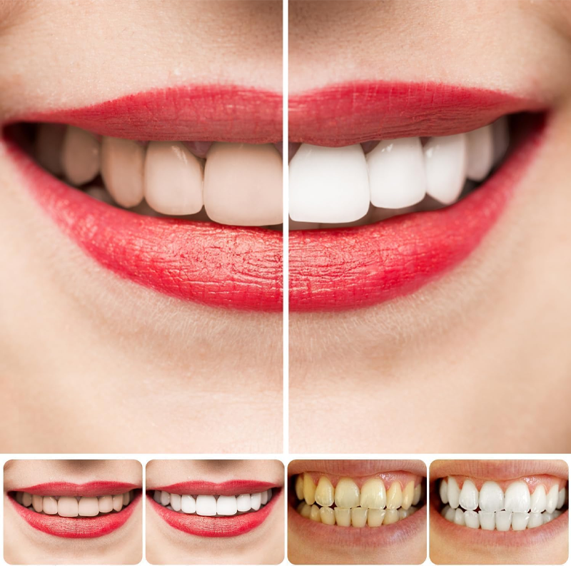 ✨ AEXZR® SP-8 Probiotic Whitening Toothpaste – Gently Erases Stains for a Brighter Smile 😁