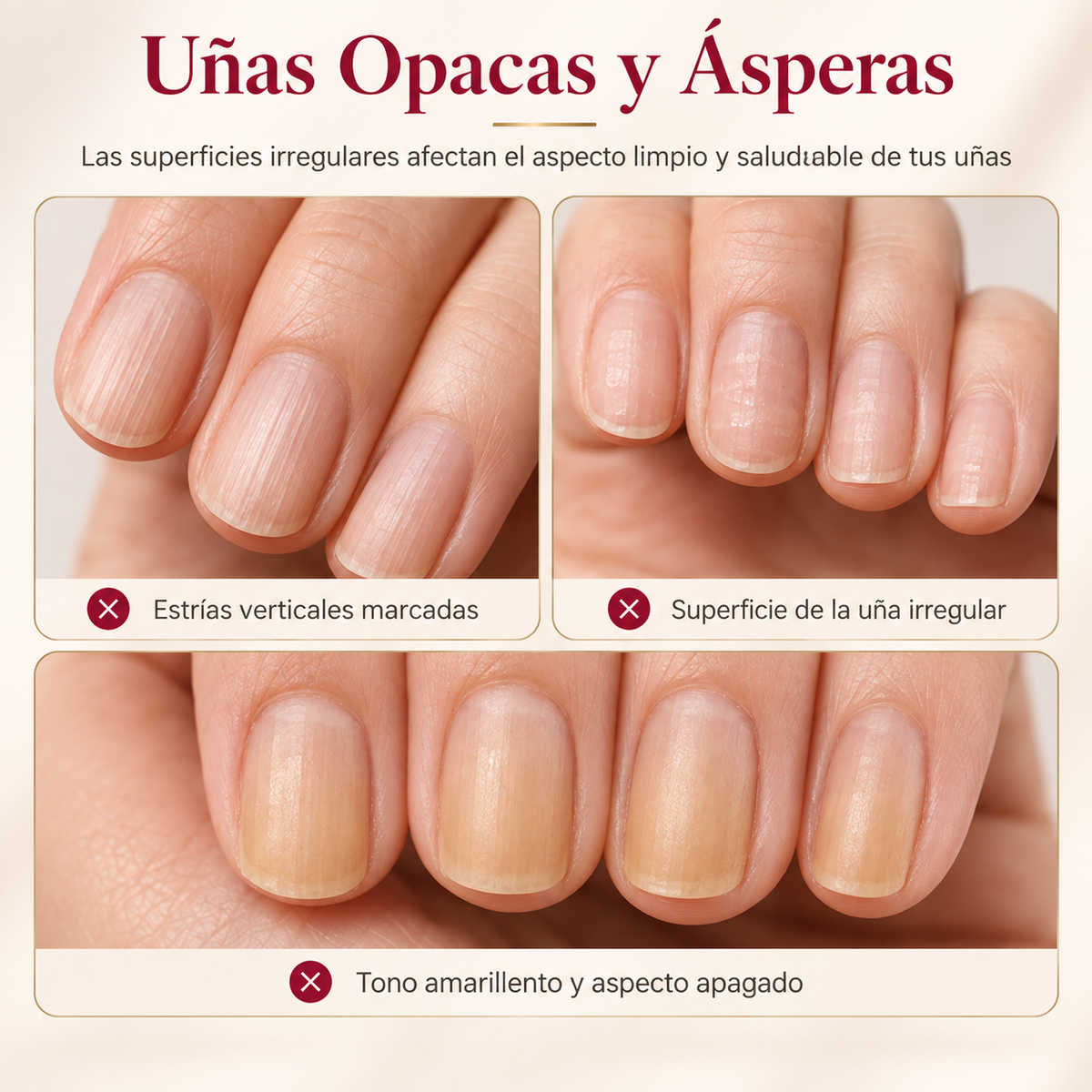 💅 Base Niveladora y Rellenador de Estrías para Uñas Lisas y Perfectas ✨
